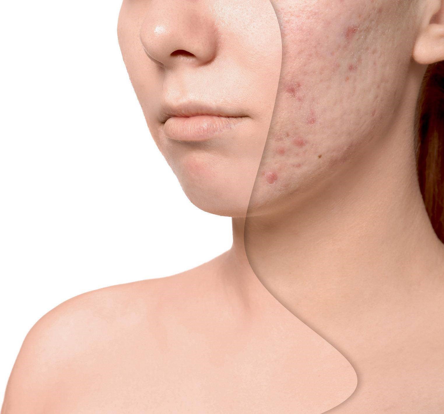 Виды аллергии на коже, симптомы